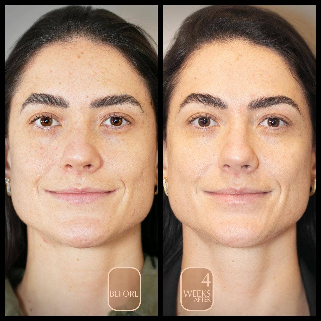 Aureterra - Acne Organic Face Cream with Rose Hydrosol